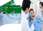 Pembuatan Gigi Palsu Melalui BPJS Kesehatan, Ini Syarat dan Prosedurnya!