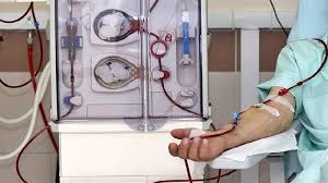 Cuci Darah Ditanggung BPJS Kesehatan, Simak Syarat dan Cara Mendapatkannya